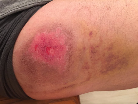 After PowerHeal (7 Days)