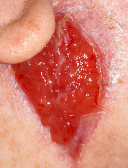 After PowerHeal (53 Days)