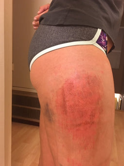 After PowerHeal (2 Days)