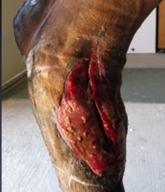 After PowerHeal (3.5 Months after Injury)