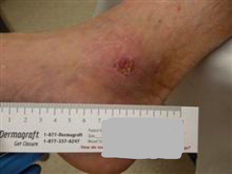 After PowerHeal (3 Weeks)