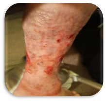 After PowerHeal (6 Months)