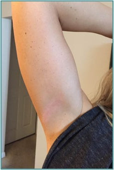 After PowerHeal (4 Days)