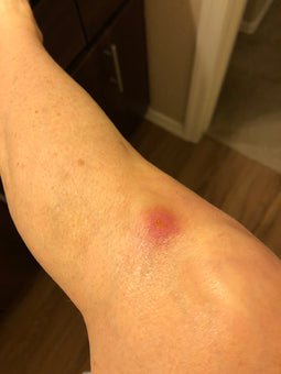 After PowerHeal (10 Days)