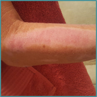 After PowerHeal (3 Weeks)