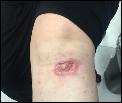 After PowerHeal (12 Days)