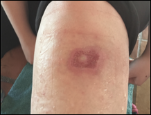 After PowerHeal (21 Days)