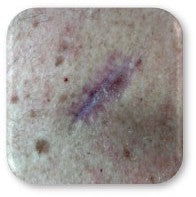 After PowerHeal (21 Days)