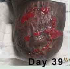 After PowerHeal (39 Days)