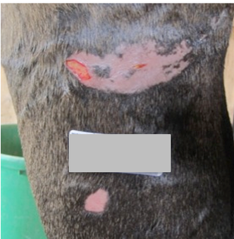 After PowerHeal - Both Wounds (Day 3)