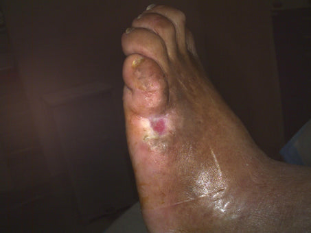 After PowerHeal (3 Months)