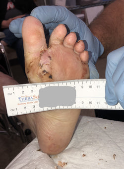 After PowerHeal (11 Days)