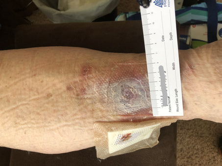 After PowerHeal (2 Months)