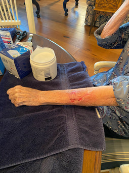 After PowerHeal (21 Days)