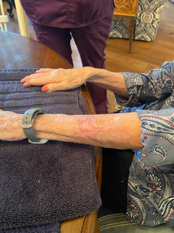 After PowerHeal (51 Days)